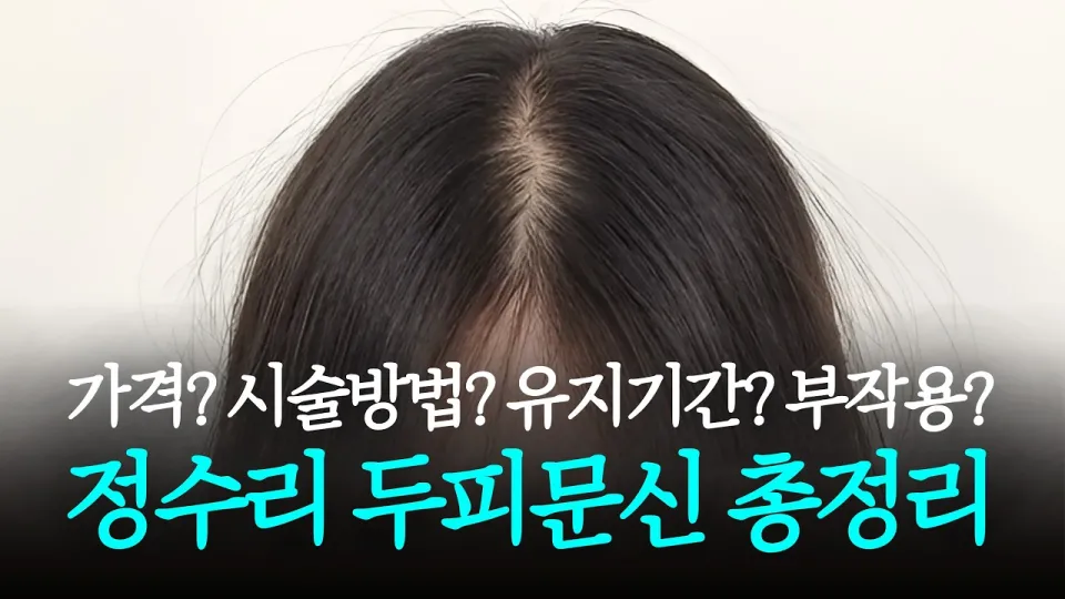 정수리 두피문신의 모든 것 [가격, 부작용, 유지기간, 시술방식까지]